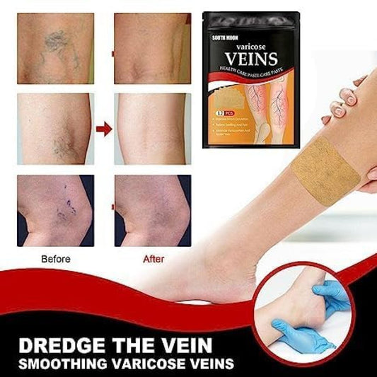 Varicose Veins Healing Patches 12 pcs - Instant Pain Relief