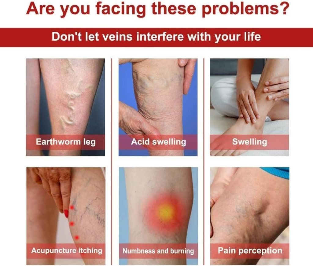 Varicose Veins Healing Patches 12 pcs - Instant Pain Relief